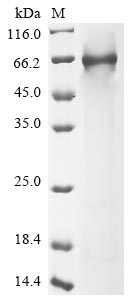 Recombinant Human Complement component C8 alpha chain (C8A) - image 1