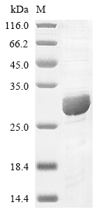 (Tris-Glycine gel) Discontinuous SDS-PAGE (reduced) with 5% enrichment gel and 15% separation gel. (Tris-Glycine gel) Discontinuous SDS-PAGE (reduced) with 5% enrichment gel and 15% separation gel.