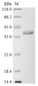 Recombinant Human Complement component C9 (C9) , partial - image 1