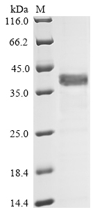 (Tris-Glycine gel) Discontinuous SDS-PAGE (reduced) with 5% enrichment gel and 15% separation gel. (Tris-Glycine gel) Discontinuous SDS-PAGE (reduced) with 5% enrichment gel and 15% separation gel.