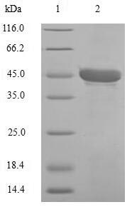 (Tris-Glycine gel) Discontinuous SDS-PAGE (reduced) with 5% enrichment gel and 15% separation gel. (Tris-Glycine gel) Discontinuous SDS-PAGE (reduced) with 5% enrichment gel and 15% separation gel.