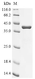 Recombinant Human Carbonic anhydrase 6 (CA6) - image 1