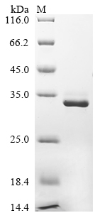 Recombinant Human Calbindin (CALB1) - image 1