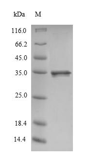 (Tris-Glycine gel) Discontinuous SDS-PAGE (reduced) with 5% enrichment gel and 15% separation gel. (Tris-Glycine gel) Discontinuous SDS-PAGE (reduced) with 5% enrichment gel and 15% separation gel.