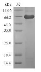 (Tris-Glycine gel) Discontinuous SDS-PAGE (reduced) with 5% enrichment gel and 15% separation gel. (Tris-Glycine gel) Discontinuous SDS-PAGE (reduced) with 5% enrichment gel and 15% separation gel.