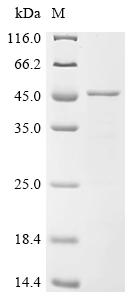 Recombinant Human Calpain-3 (CAPN3) , partial - image 1
