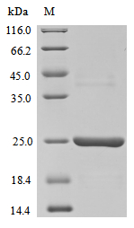 (Tris-Glycine gel) Discontinuous SDS-PAGE (reduced) with 5% enrichment gel and 15% separation gel. (Tris-Glycine gel) Discontinuous SDS-PAGE (reduced) with 5% enrichment gel and 15% separation gel.