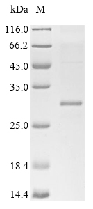 (Tris-Glycine gel) Discontinuous SDS-PAGE (reduced) with 5% enrichment gel and 15% separation gel. (Tris-Glycine gel) Discontinuous SDS-PAGE (reduced) with 5% enrichment gel and 15% separation gel.