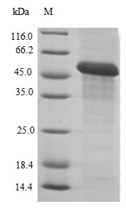 (Tris-Glycine gel) Discontinuous SDS-PAGE (reduced) with 5% enrichment gel and 15% separation gel. (Tris-Glycine gel) Discontinuous SDS-PAGE (reduced) with 5% enrichment gel and 15% separation gel.