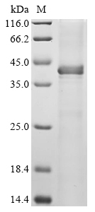 (Tris-Glycine gel) Discontinuous SDS-PAGE (reduced) with 5% enrichment gel and 15% separation gel.