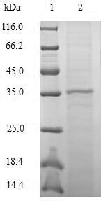 (Tris-Glycine gel) Discontinuous SDS-PAGE (reduced) with 5% enrichment gel and 15% separation gel. (Tris-Glycine gel) Discontinuous SDS-PAGE (reduced) with 5% enrichment gel and 15% separation gel.