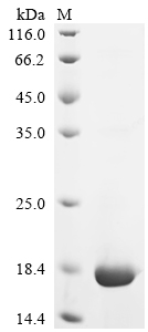 Recombinant Human C-C motif chemokine 3 (CCL3) - image 1