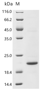 Recombinant Human C-C motif chemokine 5 (CCL5) - image 1