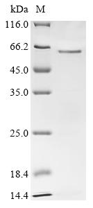 (Tris-Glycine gel) Discontinuous SDS-PAGE (reduced) with 5% enrichment gel and 15% separation gel. (Tris-Glycine gel) Discontinuous SDS-PAGE (reduced) with 5% enrichment gel and 15% separation gel.
