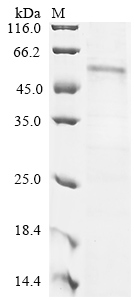 Recombinant Human G2/mitotic-specific cyclin-B1 (CCNB1) - image 1
