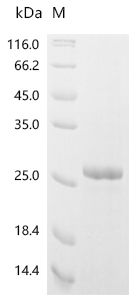 Recombinant Mouse C-C chemokine receptor type 5 (Ccr5) , partial - image 1