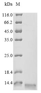 (Tris-Glycine gel) Discontinuous SDS-PAGE (reduced) with 5% enrichment gel and 15% separation gel. (Tris-Glycine gel) Discontinuous SDS-PAGE (reduced) with 5% enrichment gel and 15% separation gel.
