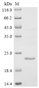 Recombinant Mouse C-C chemokine receptor-like 2 (Ccrl2) , partial - image 1