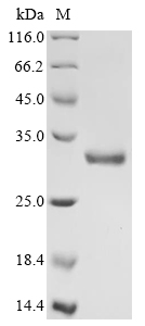 (Tris-Glycine gel) Discontinuous SDS-PAGE (reduced) with 5% enrichment gel and 15% separation gel. (Tris-Glycine gel) Discontinuous SDS-PAGE (reduced) with 5% enrichment gel and 15% separation gel.