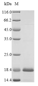 (Tris-Glycine gel) Discontinuous SDS-PAGE (reduced) with 5% enrichment gel and 15% separation gel. (Tris-Glycine gel) Discontinuous SDS-PAGE (reduced) with 5% enrichment gel and 15% separation gel.