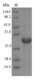 (Tris-Glycine gel) Discontinuous SDS-PAGE (reduced) with 5% enrichment gel and 15% separation gel. (Tris-Glycine gel) Discontinuous SDS-PAGE (reduced) with 5% enrichment gel and 15% separation gel.