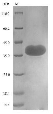 Recombinant Human CD44 antigen (CD44) , partial - image 1