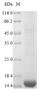 (Tris-Glycine gel) Discontinuous SDS-PAGE (reduced) with 5% enrichment gel and 15% separation gel. (Tris-Glycine gel) Discontinuous SDS-PAGE (reduced) with 5% enrichment gel and 15% separation gel.