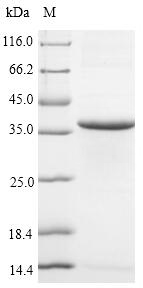 (Tris-Glycine gel) Discontinuous SDS-PAGE (reduced) with 5% enrichment gel and 15% separation gel. (Tris-Glycine gel) Discontinuous SDS-PAGE (reduced) with 5% enrichment gel and 15% separation gel.