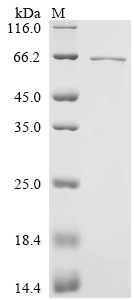 CSB-EP004952HU-B SDS-PAGE