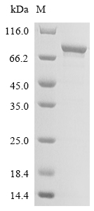 Recombinant Human HLA class II histocompatibility antigen gamma chain (CD74) , partial - image 1
