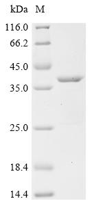 Recombinant Mouse CD81 antigen (Cd81) , partial - image 1
