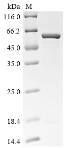 (Tris-Glycine gel) Discontinuous SDS-PAGE (reduced) with 5% enrichment gel and 15% separation gel. (Tris-Glycine gel) Discontinuous SDS-PAGE (reduced) with 5% enrichment gel and 15% separation gel.