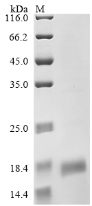 (Tris-Glycine gel) Discontinuous SDS-PAGE (reduced) with 5% enrichment gel and 15% separation gel. (Tris-Glycine gel) Discontinuous SDS-PAGE (reduced) with 5% enrichment gel and 15% separation gel.