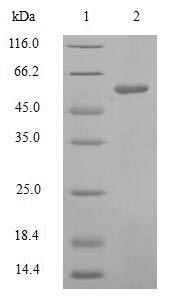 SDS-PAGE- Recombinant protein Human CDC25C