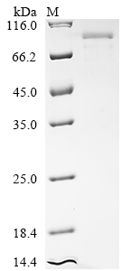 Recombinant Human Major centromere autoantigen B (CENPB) - image 1