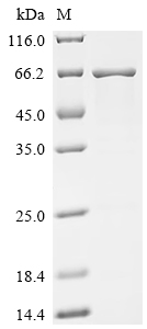 Recombinant Human Carboxylesterase 3 (CES3) - image 1