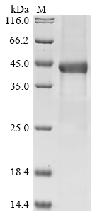 Recombinant Human Complement factor H-related protein 1 (CFHR1) , partial - image 1