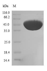 (Tris-Glycine gel) Discontinuous SDS-PAGE (reduced) with 5% enrichment gel and 15% separation gel. (Tris-Glycine gel) Discontinuous SDS-PAGE (reduced) with 5% enrichment gel and 15% separation gel.