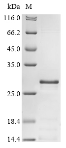 (Tris-Glycine gel) Discontinuous SDS-PAGE (reduced) with 5% enrichment gel and 15% separation gel. (Tris-Glycine gel) Discontinuous SDS-PAGE (reduced) with 5% enrichment gel and 15% separation gel.