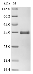 Recombinant Human Muscarinic acetylcholine receptor M2 (CHRM2) , partial - image 1