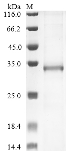 CSB-EP005383HUb0