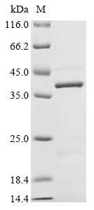 (Tris-Glycine gel) Discontinuous SDS-PAGE (reduced) with 5% enrichment gel and 15% separation gel. (Tris-Glycine gel) Discontinuous SDS-PAGE (reduced) with 5% enrichment gel and 15% separation gel.