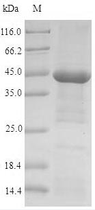 (Tris-Glycine gel) Discontinuous SDS-PAGE (reduced) with 5% enrichment gel and 15% separation gel. (Tris-Glycine gel) Discontinuous SDS-PAGE (reduced) with 5% enrichment gel and 15% separation gel.