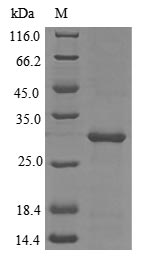 (Tris-Glycine gel) Discontinuous SDS-PAGE (reduced) with 5% enrichment gel and 15% separation gel. (Tris-Glycine gel) Discontinuous SDS-PAGE (reduced) with 5% enrichment gel and 15% separation gel.