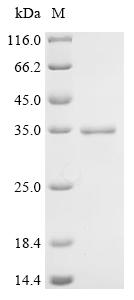 Recombinant Human Acetylcholine receptor subunit beta (CHRNB1) , partial - image 1