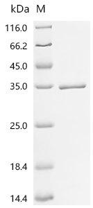 Recombinant Human Acetylcholine receptor subunit beta (CHRNB1) , partial - image 1