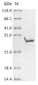 (Tris-Glycine gel) Discontinuous SDS-PAGE (reduced) with 5% enrichment gel and 15% separation gel. (Tris-Glycine gel) Discontinuous SDS-PAGE (reduced) with 5% enrichment gel and 15% separation gel.