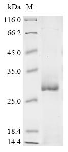 Recombinant Human Acetylcholine receptor subunit gamma (CHRNG) , partial - image 1
