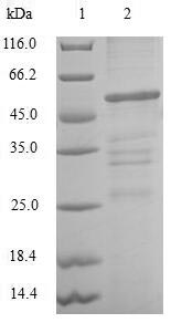 (Tris-Glycine gel) Discontinuous SDS-PAGE (reduced) with 5% enrichment gel and 15% separation gel. (Tris-Glycine gel) Discontinuous SDS-PAGE (reduced) with 5% enrichment gel and 15% separation gel.