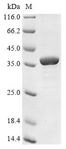 (Tris-Glycine gel) Discontinuous SDS-PAGE (reduced) with 5% enrichment gel and 15% separation gel. (Tris-Glycine gel) Discontinuous SDS-PAGE (reduced) with 5% enrichment gel and 15% separation gel.